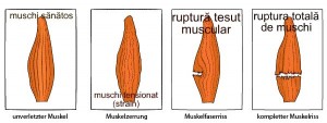 masaj terapeutic