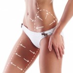 tonifiere si fermitate