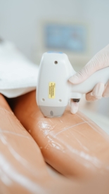 epilare definitivă laser diodă Cluj-Napoca